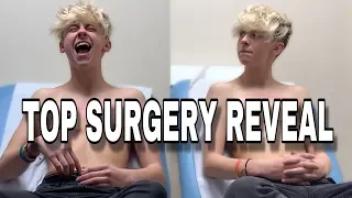 FTM TOP SURGERY REVEAL- vlog part 2  | NOAHFINNCE