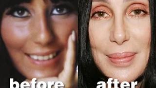 10 People Who Had Plastic Surgery to Look Like a Celebrity | Amazing Pictures