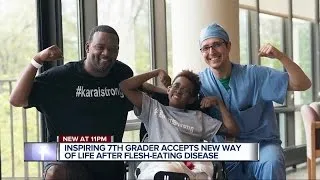 Inspiring 7th grader accepts new way of life after flesh-eating disease