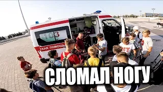 СЛОМАЛ НОГУ НА СТРИТ-ДЖЕМЕ