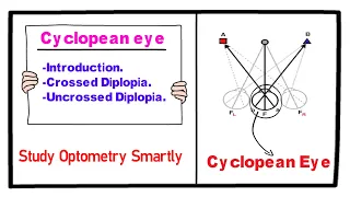 Cyclopean Eye (Crossed & Uncrossed Diplopia)