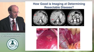 Debate: Is there a role for surgical management of metastatic neuroendocrine cancer? - Yes