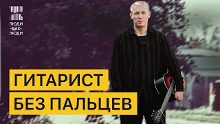 Я потерял пальцы, но играю на гитаре