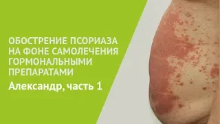 Обострение псориаза на фоне самолечения гормональными препаратами