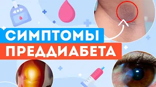 10 ГЛАВНЫХ СИМПТОМОВ ПРЕДДИАБЕТА | ВАЖНО ЗНАТЬ!