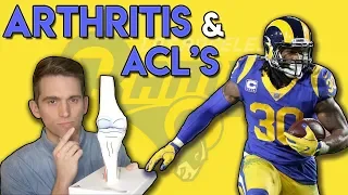 Todd Gurley Arthritis and ACL Tears | Doctor Explains the Connection