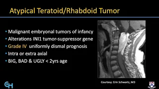 Imaging Pediatric spine tumors