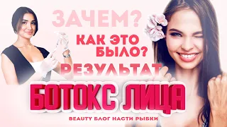 BEAUTY БЛОГ НАСТИ РЫБКИ | БОТОКС ЛИЦА