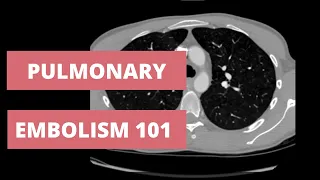 How to Identify a Pulmonary Embolism on CT - Search Pattern for CTA chest