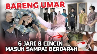 NGILUUU BANGET 😰❗BEBERAPA JARINYA HAMPIR PUT#S | BERSAMA UMAR