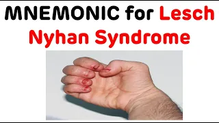 Lesch Nyhan Syndrome Mnemonic || Mnemonic to Remember Lesch Nyhan Syndrome || Lesch Nyhan Syndrome