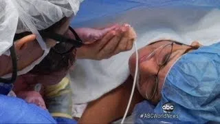 Miracle Baby: Heart Surgery Before Birth Saves Baby's Life