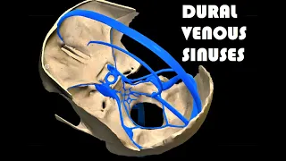 3D ANATOMY OF DURAL VENOUS SINUSES