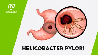 Helicobacter pylori – przyczyny, objawy, leczenie, dieta