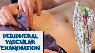 Peripheral Vascular Examination - OSCE Guide (old version) | UKMLA | CPSA