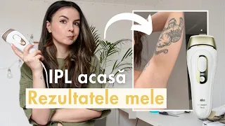 Epilarea definitivă acasă, funcționează? Review Braun IPL Pro 5 vs. Phillips Lumea | Rezultate ipl