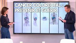 Cancer Colorectal : Prévenir et Guérir - Allo Docteurs