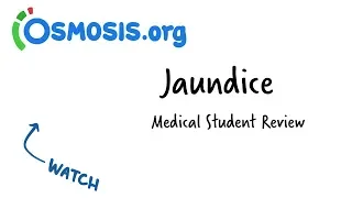 Jaundice | Clinical Presentation