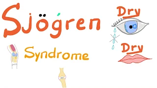 Sjögren Syndrome | Rheumatology