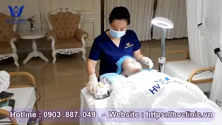 ĐIỀU TRỊ MỤN ĐẦU ĐEN, MỤN ẨN CHO EM GÁI MIỀN TÂY DỄ THƯƠNG  HHV CLINIC| Đỗ Thu Hiền |