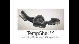 TempShell Immediate Implant Temporization Technique