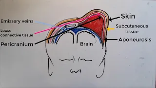 Caput Succedaneum V Cephalohematoma - a comprehensive  explanation