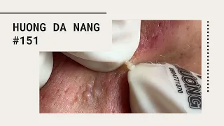 #151 | Huong Da Nang