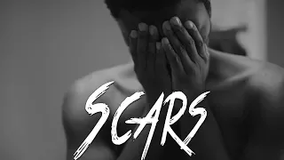 SCARS - Very Sad Emotional Rap Beat | Sad Storytelling Instrumental