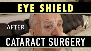 How to apply the EYE SHIELD after CATARACT SURGERY | Eye Shield Instructions after Eye Surgery