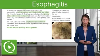 Esophagitis with Case – Disorders of the Esophagus and the Stomach | Lecturio