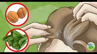 6 Causes of Premature Graying of Hair