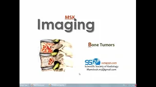 Imaging of Bone tumors (I) (DRE) Prof. Mamdouh Mahfouz