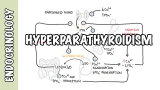 Hyperparathyroidism and the different types, causes, pathophysiology, treatment