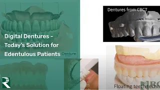 Digital Dentures – Today’s Solution for Edentulous Patients - CHROME Live Webinar Series (7/12)
