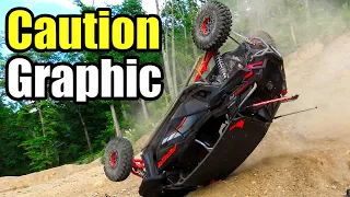 SxS Crashes Epic Compilation