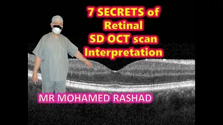 Super secrets to easily interpret Retinal Spectral Domain Optical Coherence Tomography