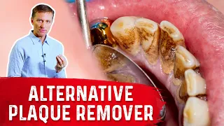 Dental Plaque Removal Using Only 3 Ingredients: Tea Tree Oil, Xylitol, and Coconut Oil – Dr.Berg