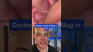 Doctor reacts to a big bug extraction out of an ear! #bug #ear #dermreacts #extraction