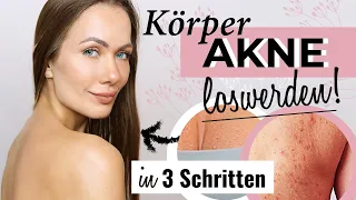 🙆‍♀️ Pickel am Rücken, Brust & Arm loswerden! - So habe ich es geschafft!