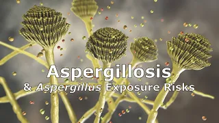 Aspergillosis and Aspergillus Exposure Risks
