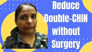 Watch this for Removing Double chin Without Surgery ( Only Exercises ) I Dr.Lalita I Hindi