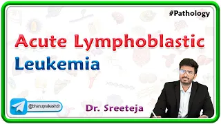 15. Acute Lymphoblastic Leukemia (ALL) | USMLE Step 1 Pathology