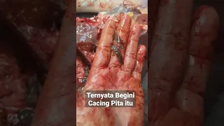 Penampakan Cacing hati di Ati Sapi Kurb4n