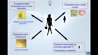 Conséquences de la chirurgie et devoir du chirurgien sur la préservation de la fertilité