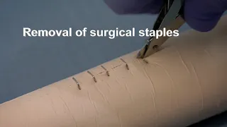 Placing and removing surgical wound closure staples