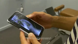 Dr. Bobby Fano DC - Gonstead Chiropractic adjustment 26 yoa female with iPhone spinal image review