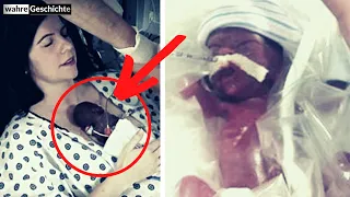 Ihr Baby hatte keine Überlebenschance, als sie es auf ihre Brust legte, waren die Ärzte schockiert!