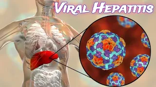 Viral Hepatitis - CRASH! Medical Review Series
