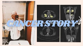 MY CANCER STORY. Stage 4 Hodgkin's Lymphoma at 21