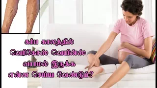 How to prevent #Varicose Veins during #Pregnancy? | Hello Doctor - Dr.Gowthaman's Live Talk Show